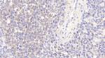 WASP Antibody in Immunohistochemistry (Paraffin) (IHC (P))