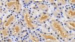 XIAP Antibody in Immunohistochemistry (Paraffin) (IHC (P))