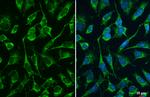 DLST Antibody in Immunocytochemistry (ICC/IF)