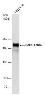 ErbB2 (HER-2) Antibody in Western Blot (WB)