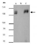 mCherry Antibody in Immunoprecipitation (IP)