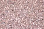 MEK1 Antibody in Immunohistochemistry (Paraffin) (IHC (P))