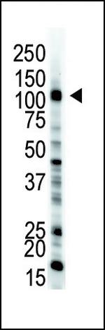 UBE1 Antibody in Western Blot (WB)