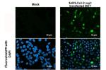 SARS-CoV-2 NSP1 Antibody in Immunocytochemistry (ICC/IF)