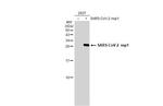 SARS-CoV-2 NSP1 Antibody in Western Blot (WB)