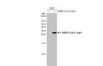 SARS-CoV-2 NSP1 Antibody in Western Blot (WB)