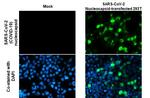 SARS/SARS-CoV-2 Nucleocapsid Antibody in Immunocytochemistry (ICC/IF)