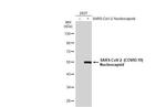 SARS/SARS-CoV-2 Nucleocapsid Antibody in Western Blot (WB)