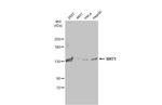 SIRT1 Antibody in Western Blot (WB)