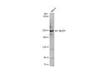 SLIT1 Antibody in Western Blot (WB)