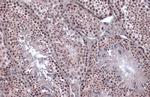 SNAIL Antibody in Immunohistochemistry (Paraffin) (IHC (P))