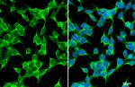 TAK1 Antibody in Immunocytochemistry (ICC/IF)