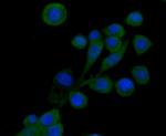 SNAIL Antibody in Immunocytochemistry (ICC/IF)