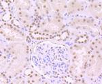 SNAIL Antibody in Immunohistochemistry (Paraffin) (IHC (P))