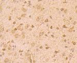 ROBO1 Antibody in Immunohistochemistry (Paraffin) (IHC (P))