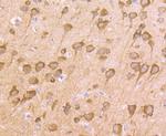 Nrf2 Antibody in Immunohistochemistry (Paraffin) (IHC (P))