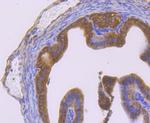 Nrf2 Antibody in Immunohistochemistry (Paraffin) (IHC (P))