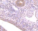 Nrf2 Antibody in Immunohistochemistry (Paraffin) (IHC (P))