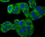 ROCK2 Antibody in Immunocytochemistry (ICC/IF)