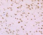 ROCK2 Antibody in Immunohistochemistry (Paraffin) (IHC (P))