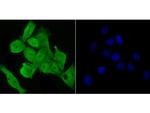 FOXM1 Antibody in Immunocytochemistry (ICC/IF)