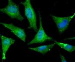 ATP Citrate Lyase Antibody in Immunocytochemistry (ICC/IF)