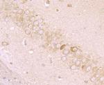 MMP3 Antibody in Immunohistochemistry (Paraffin) (IHC (P))