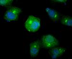 SMAD4 Antibody in Immunocytochemistry (ICC/IF)