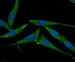 SMAD4 Antibody in Immunocytochemistry (ICC/IF)