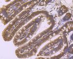 beta Arrestin 1 Antibody in Immunohistochemistry (Paraffin) (IHC (P))