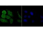 PKC beta Antibody in Immunocytochemistry (ICC/IF)