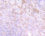 PKC beta Antibody in Immunohistochemistry (Paraffin) (IHC (P))