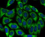 Protein APC Antibody in Immunocytochemistry (ICC/IF)