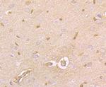 Protein APC Antibody in Immunohistochemistry (Paraffin) (IHC (P))