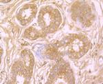 Protein APC Antibody in Immunohistochemistry (Paraffin) (IHC (P))