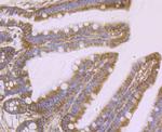 Protein APC Antibody in Immunohistochemistry (Paraffin) (IHC (P))