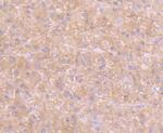 GOT1 Antibody in Immunohistochemistry (Paraffin) (IHC (P))