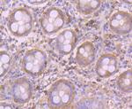 GOT1 Antibody in Immunohistochemistry (Paraffin) (IHC (P))