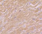 GOT1 Antibody in Immunohistochemistry (Paraffin) (IHC (P))