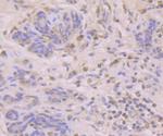 B7-H4 Antibody in Immunohistochemistry (Paraffin) (IHC (P))