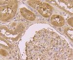 B7-H4 Antibody in Immunohistochemistry (Paraffin) (IHC (P))