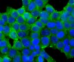 Carbonic anhydrase II Antibody in Immunocytochemistry (ICC/IF)