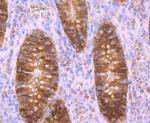 Carbonic anhydrase II Antibody in Immunohistochemistry (Paraffin) (IHC (P))