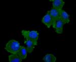 TAK1 Antibody in Immunocytochemistry (ICC/IF)