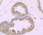 TAK1 Antibody in Immunohistochemistry (Paraffin) (IHC (P))