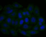 UQCRC2 Antibody in Immunocytochemistry (ICC/IF)