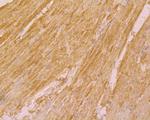 UQCRC2 Antibody in Immunohistochemistry (Paraffin) (IHC (P))