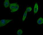 Prolactin Antibody in Immunocytochemistry (ICC/IF)