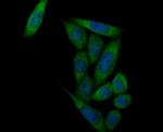 Prolactin Antibody in Immunocytochemistry (ICC/IF)