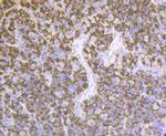 Prolactin Antibody in Immunohistochemistry (Paraffin) (IHC (P))